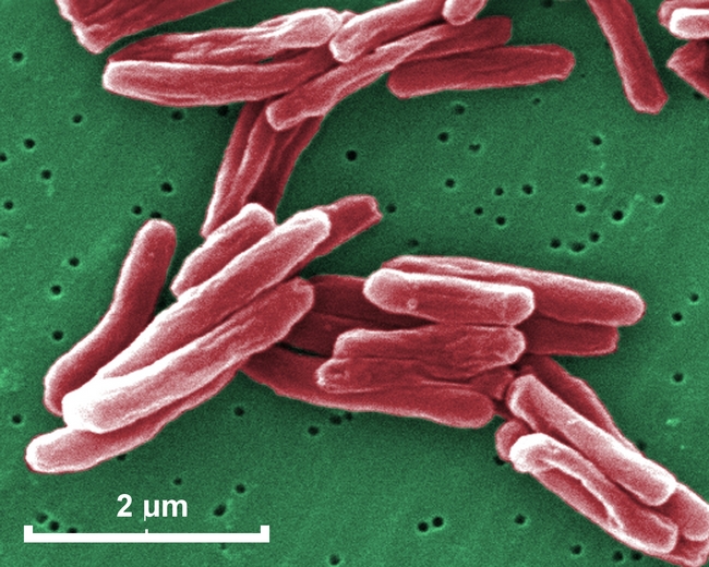 mycobacterium tuberculosis electron micrograph